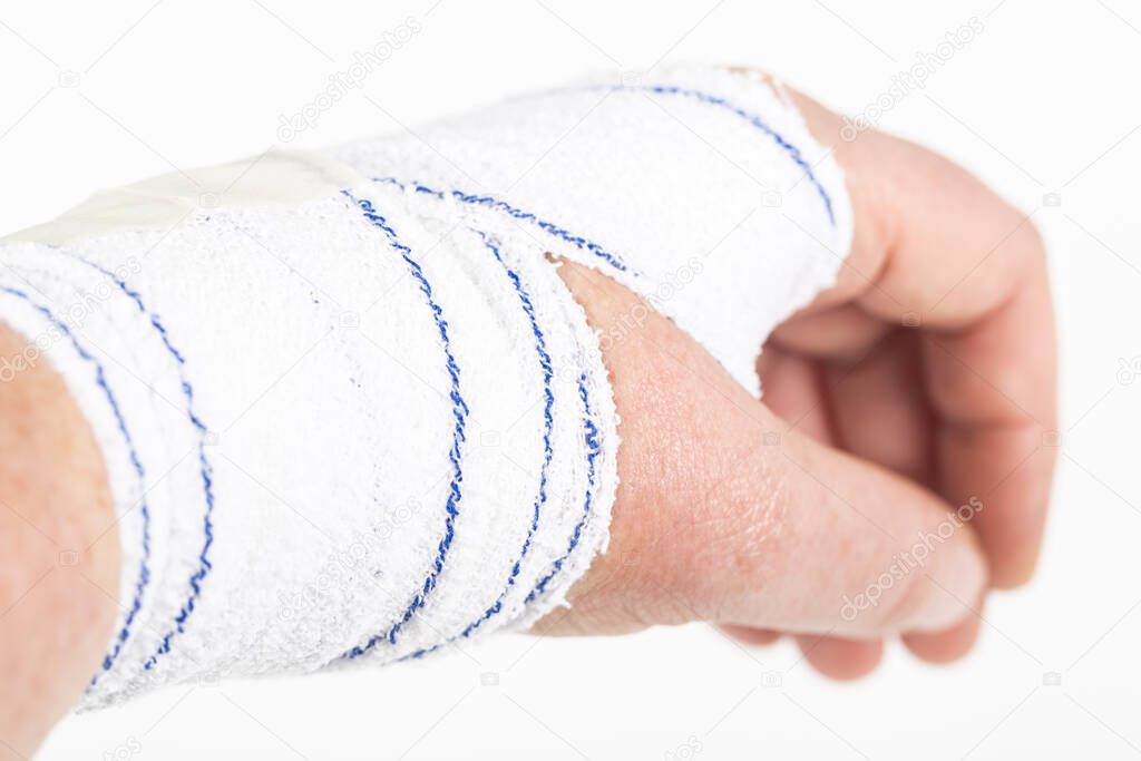 chemical burn on the wrist skin with hydroxide sodium acid. Festering and deep wound. Household accident, because of blue gloves to sharp. Medical bandage on it. Selective focus