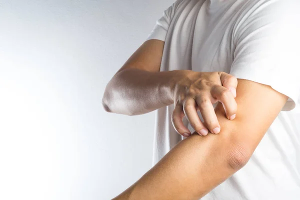 Adam çizik kaşıntı