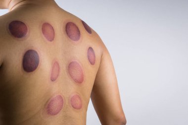 A man back with blood marks massaged clipart