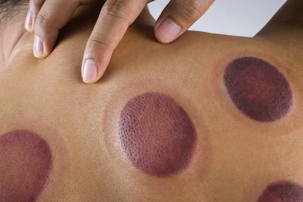 Geri masaj kan izleri olan bir adam