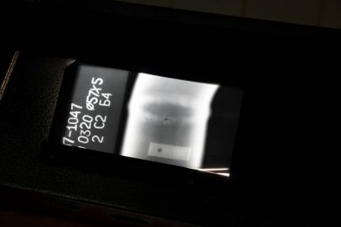 Frenlenemez kontrol. Petrokimya şirketindeki boru hattının kaynaklarının röntgenleri. Kaynak evliliği. Gözeneklerin birikimi.                         