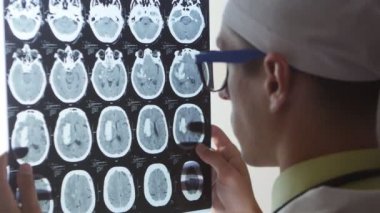 Bir beyin cerrahı doktor bir manyetik rezonans görüntüleme MRG sırasında anlık görüntü görüntü beyin görünüyor