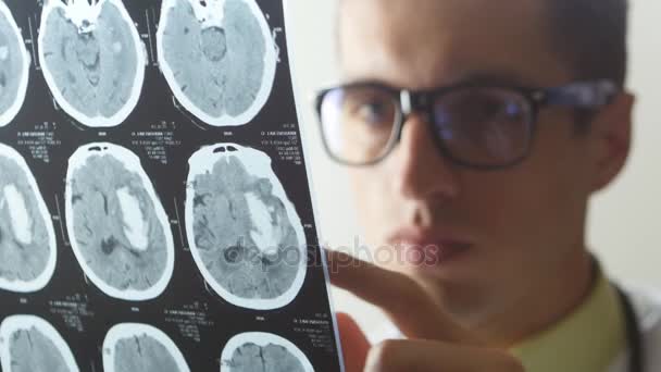 Close up of Doctor examines a snapshot of magnetic resonance imaging — Stock Video