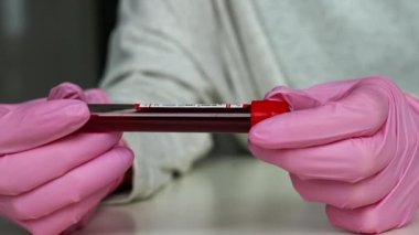 Pozitif ve Negatif Kapsamlı 19 Test ve Laboratuar Kan Numunesi