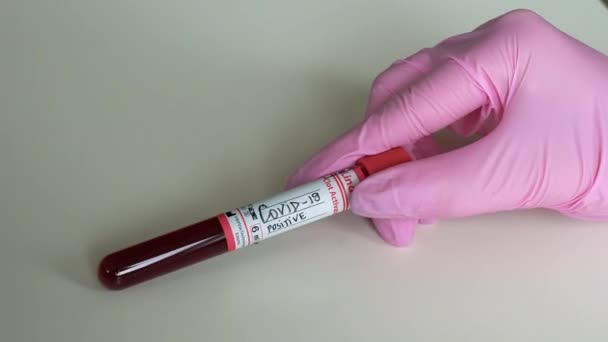 Teste Covid Positivo Negativo Amostra Laboratório Sangue — Vídeo de Stock