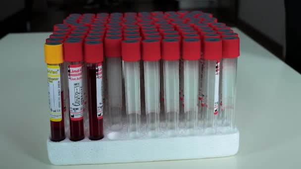 Positiver Und Negativer Covid Test Und Laborprobe Von Blut — Stockvideo