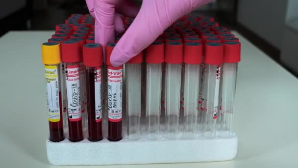 Prueba Positiva Negativa Covid Muestra Laboratorio Sangre — Vídeo de stock