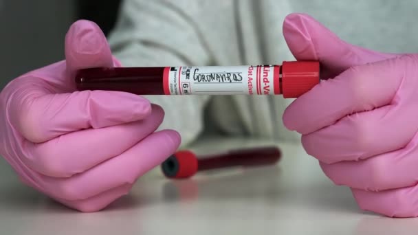 Teste Covid Positivo Negativo Amostra Laboratório Sangue — Vídeo de Stock
