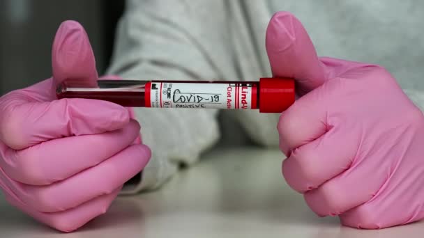 Pozytywny Negatywny Wynik Testu Covid Laboratoryjnej Próbki Krwi — Wideo stockowe