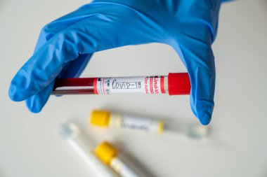 Doktor, Wuhan 'dan gelen yeni Corona virüsü enfeksiyonunun teşhisi için pozitif ve negatif sonuçlar içeren COVID-19 kan örneklerini tutuyor. Bulaşıcı salgın konsepti