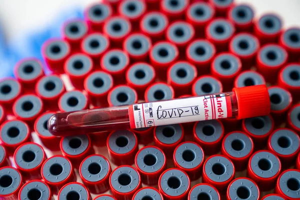 Wuhan Dan Yeni Corona Virüsü Enfeksiyonu Teşhisi Için Pozitif Covid — Stok fotoğraf
