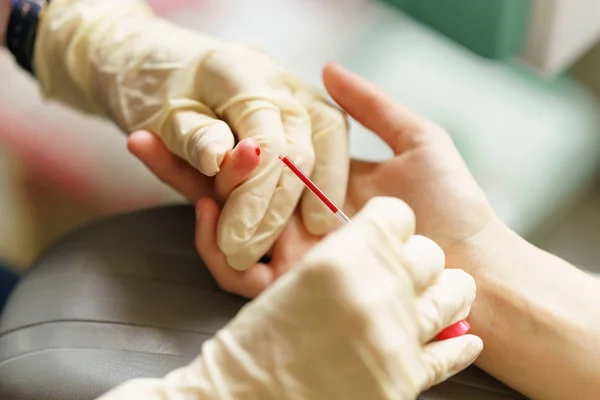 Enfermera médica con guantes de látex está tomando la sangre del paciente para su análisis — Foto de Stock