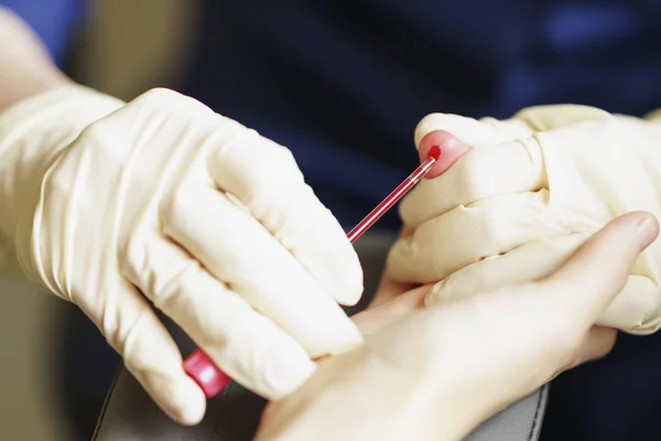 Enfermera médica con guantes de látex recoger sangre para el análisis o la prueba del VIH — Foto de Stock