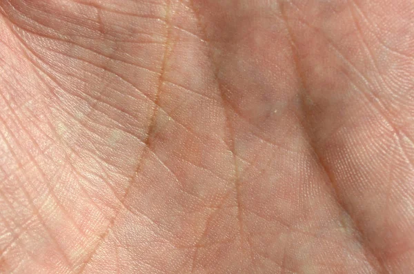 Close Human Hand Skin Visible Skin Texture Lines — Stock Photo, Image