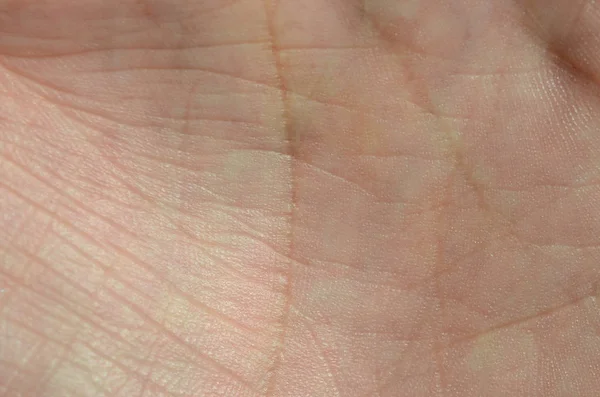 Närbild Mänsklig Hand Hud Med Synliga Hudens Struktur Och Linjer — Stockfoto