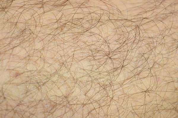 Detalhe fechado de pele humana com cabelo. Mans perna peluda — Fotografia de Stock