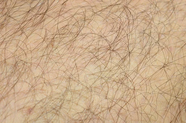 Close Detail Human Skin Hair Mans Hairy Leg — Stock Photo, Image