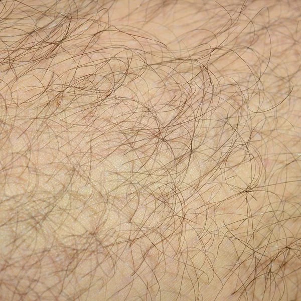 Close Detail Human Skin Hair Mans Hairy Leg — Stock Photo, Image