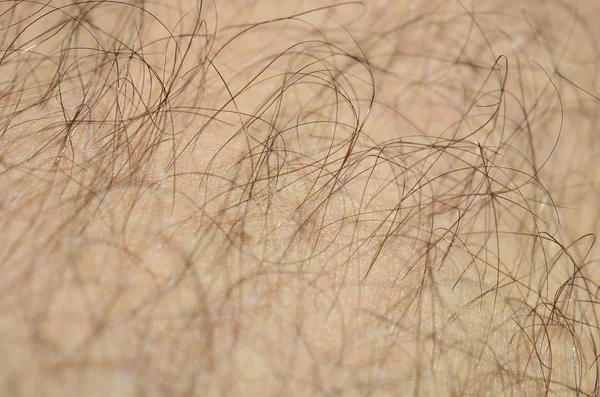 Close Detail Human Skin Hair Mans Hairy Leg — Stock Photo, Image