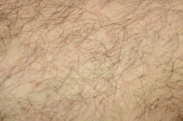 Close Detail Human Skin Hair Mans Hairy Leg — Stock Photo, Image