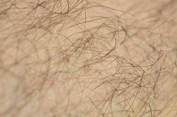 Close up detail of human skin with hair. Mans hairy leg