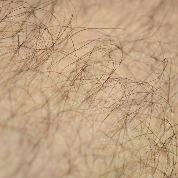 Close up detail of human skin with hair. Mans hairy leg