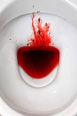 Beyaz seramik klozet kan lekeli. Belirgin adet, dysbacteriosis, dizanteri, basur, kanser ve diğer hastalıkları benzer semptomlarla birlikte sonuçları