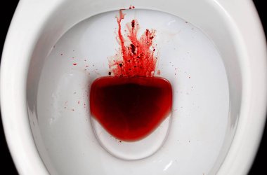 Beyaz seramik klozet kan lekeli. Belirgin adet, dysbacteriosis, dizanteri, basur, kanser ve diğer hastalıkları benzer semptomlarla birlikte sonuçları