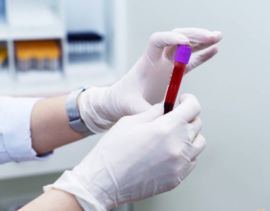 Beyaz lastik eldivenli kadın bir doktor laboratuarda üzerinde kan örneği olan bir test tüpü tutuyor. Tedavi, koronavirüs, salgın, COVID-19