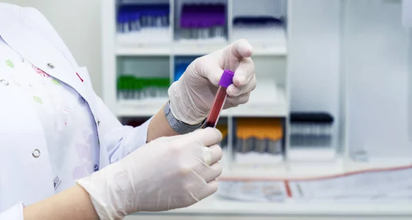 A female doctor in white rubber gloves holds a test tube with a blood sample in the laboratory. Treatment, coronavirus, pandemic, COVID-19