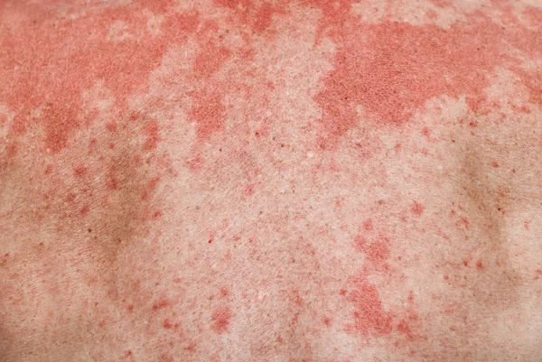 Фон людської шкіри з алергічними плямами . — стокове фото