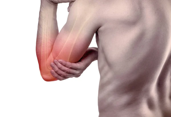 Έννοια Τραυματισμού Αγκώνα Άνθρωπος Κρατάει Ένα Πληγωμένο Χέρι Εξάρθρωση Ένα — Φωτογραφία Αρχείου