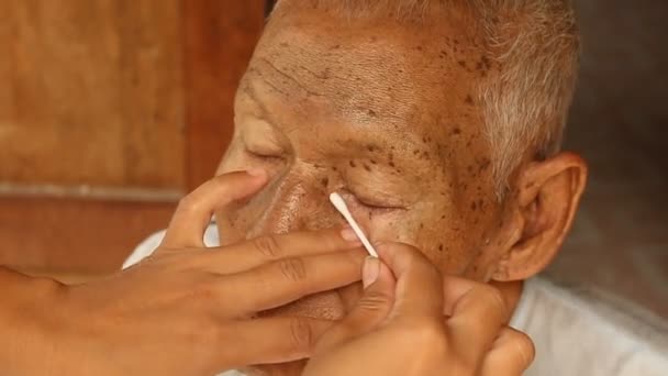 Hand vrouwen schoonmaken eye haar vader vóór gebruik oogdruppels — Stockvideo