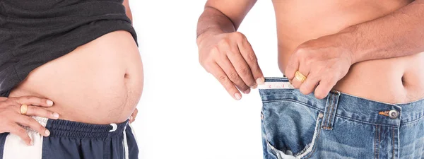Young man show body after weight loss — Stock Photo, Image