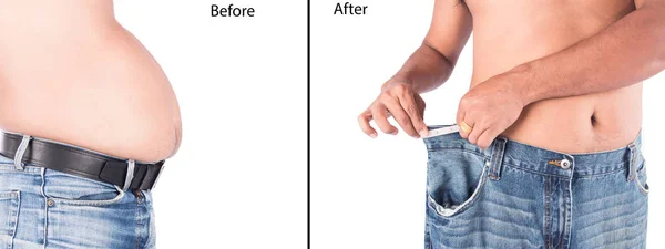Young man show body after weight loss — Stock Photo, Image