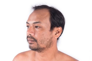 Yüz adam kel kafası closeup