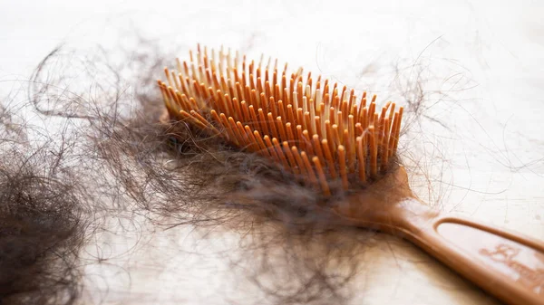 tarakta siyah saç kaybı