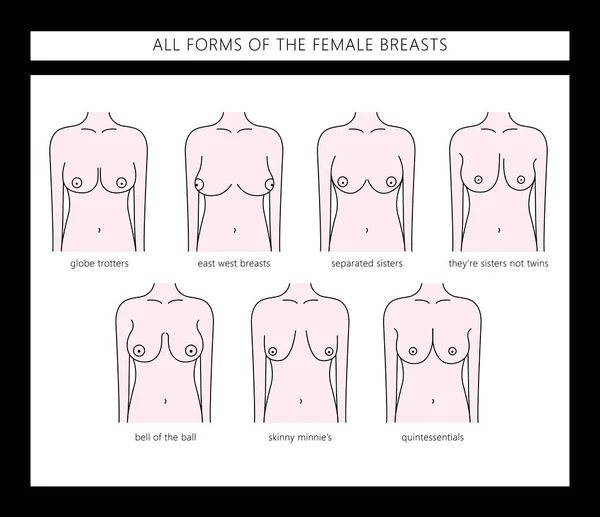 Typer av kvinnors bröst — Stock vektor