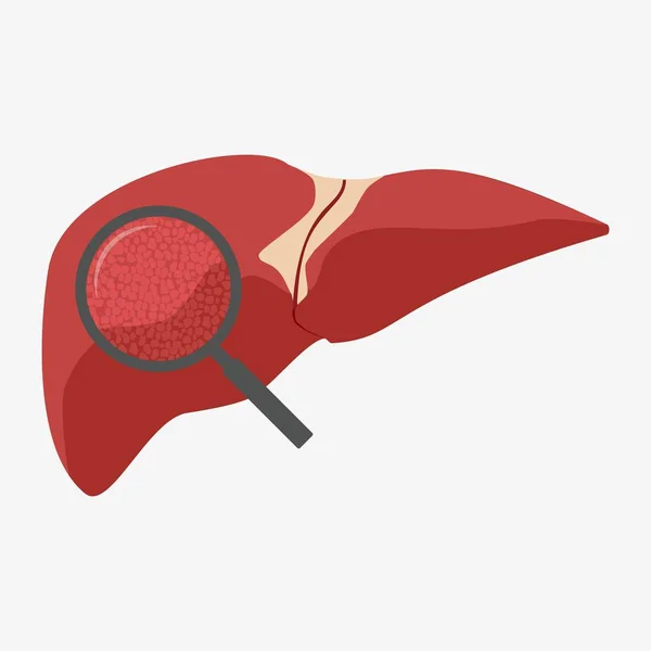 Печінка людини зі збільшувальним склом — стоковий вектор