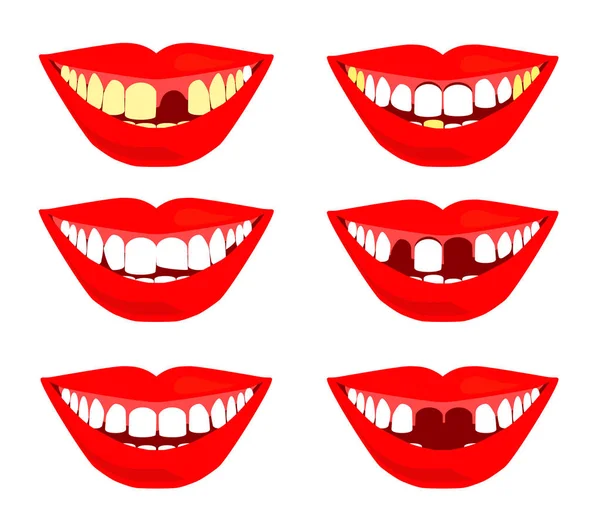 Улыбка Зубами Белом Фоне Проблемы Стоматологии Протезирования Зубов Векторная Иллюстрация — стоковый вектор