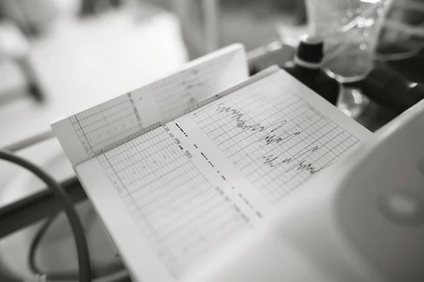 Printing of cardiogram report — Stock Photo, Image