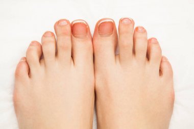 Kadın ayak pedikür çivi. Besin eksikliği. Yakın çekim görünümü. Yüzü olmayan.