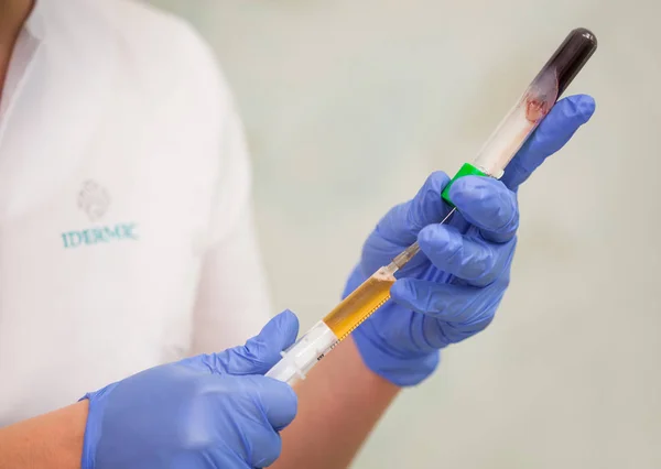 Pohled na detail kosmetička rukou získává krev z trubice do injekční stříkačky s kyselinou hyaluronovou. Příprava k plasmolifting postup. — Stock fotografie