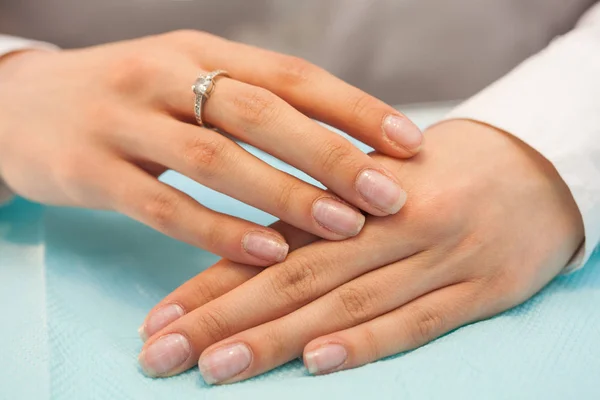 Erkek besin eksikliği ile çivi. Yakın çekim görünümü. Hiç manikür, yüzü olmayan.