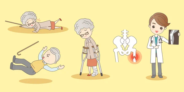 Desenhos animados pessoas idosas fraturas no pé — Vetor de Stock