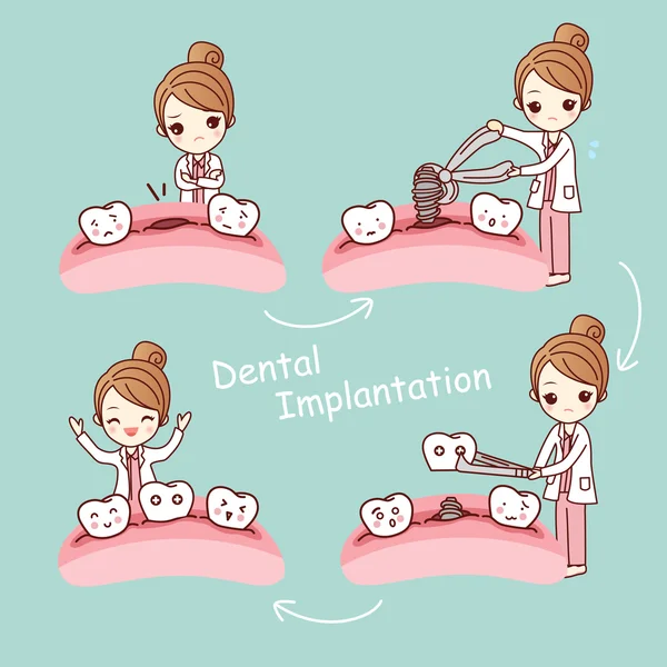 Kreslený zubní zubní implantaci koncept — Stockový vektor