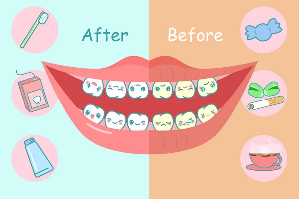 Antes e depois dos dentes —  Vetores de Stock