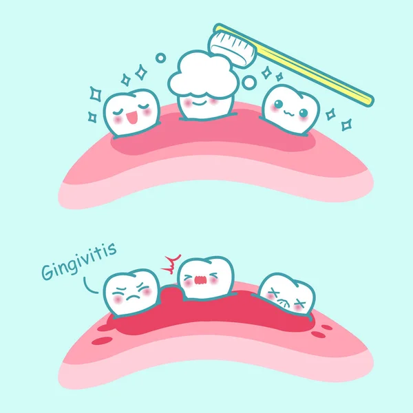 Brosse à dents dessin animé et gingivite — Image vectorielle