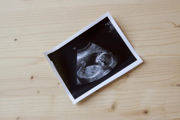 Sonogram ahşap üzerine