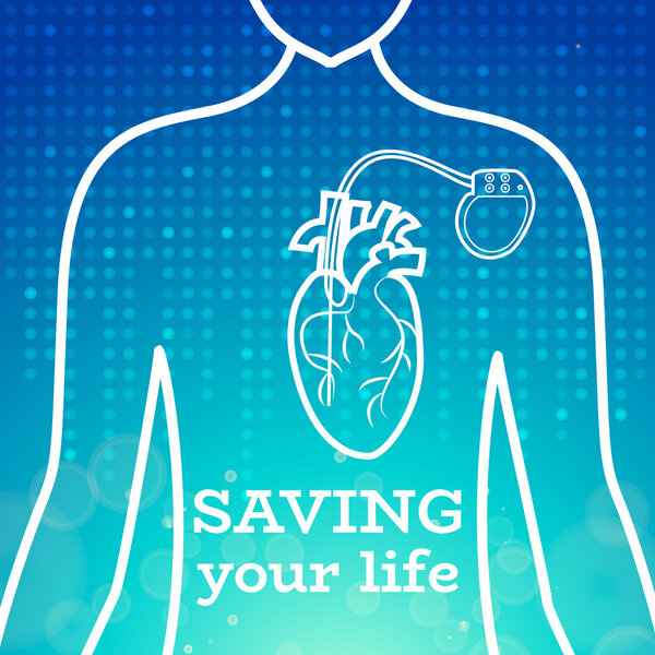 Кардиостимулятор
